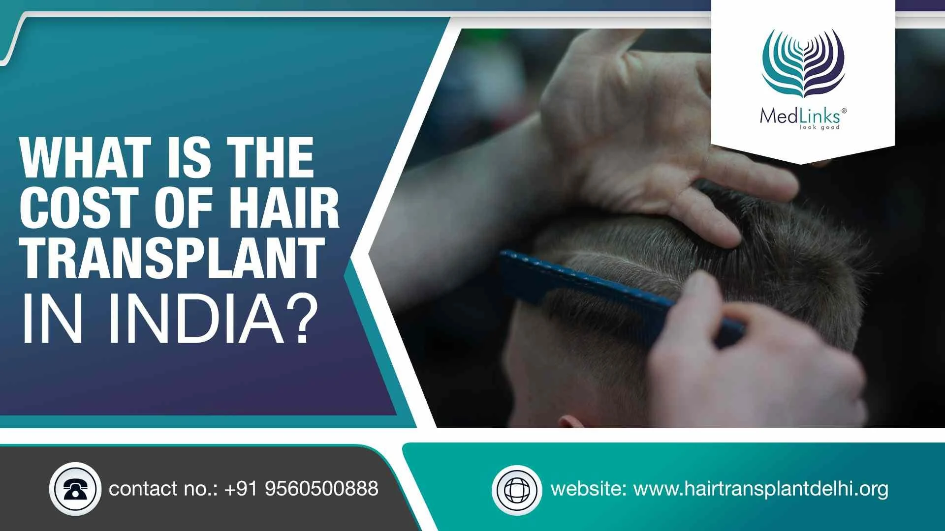 Hair Transplant Cost In India