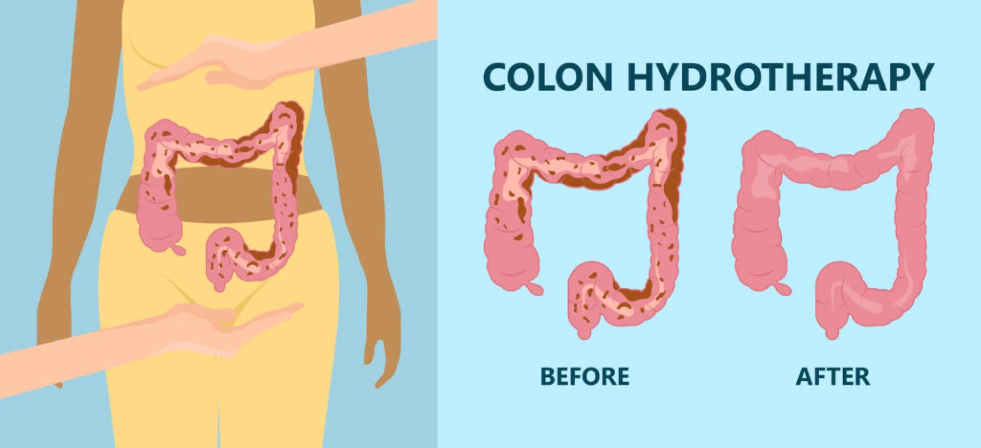 Colon hydrotherapy and its many benefits | detoxification through medical massage