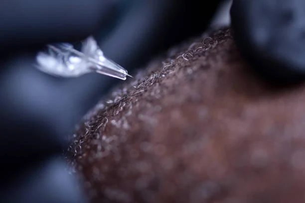 Tattoo hair: non-surgical hair loss procedure