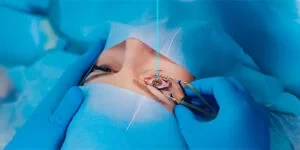 LASIK Eye Surgery: Is It Right for You? Exploring Benefits, Risks and Common Side Effects