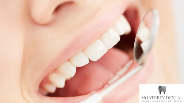 Smiles for All Ages: The Importance of Family Dentistry