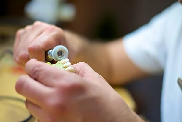 Restoring Smiles: How Dental Crowns and Bridges Improve Aesthetics and Functionality