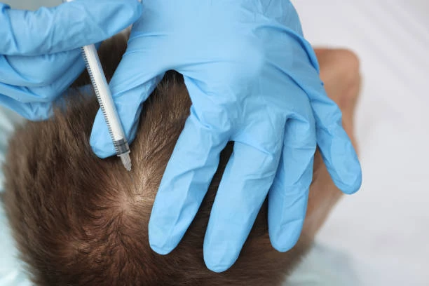 Scalp Micropigmentation Maintenance: Tips for Long-lasting Results in Abu Dhabi