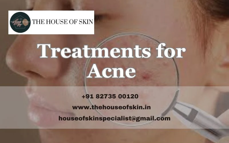 Beyond the Zit: A Comprehensive Guide to Understanding and Treating Acne