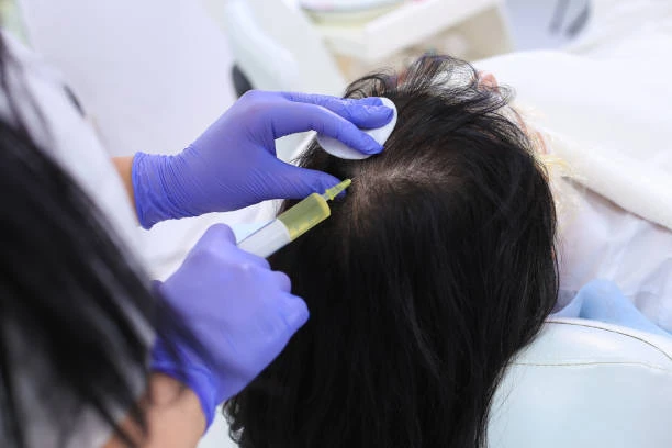 Transform Your Appearance: Concentrated Growth Factor in Riyadh