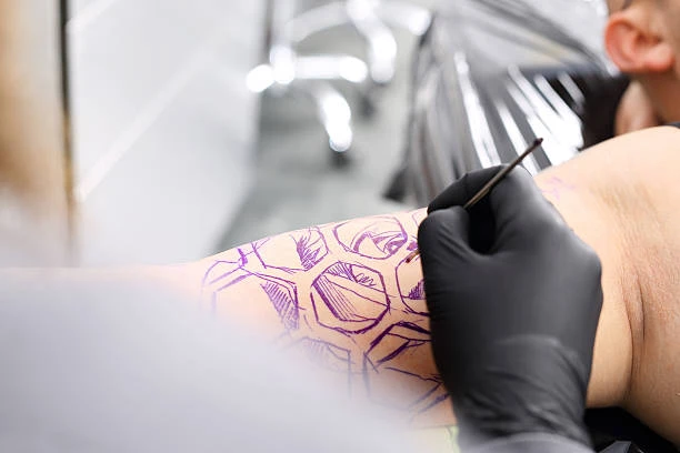 Reclaim Your Skin: Top Tattoo Removal Paper in Riyadh