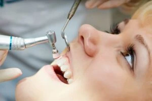 How Often Should You Get Your Teeth Cleaned? A Dentist's Perspective