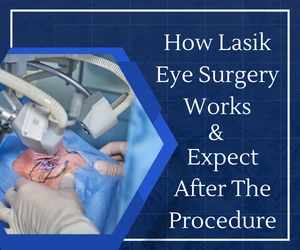 How Lasik Eye Surgery Works, And What To Expect After The Procedure?