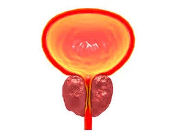 Prostatite o que é isso