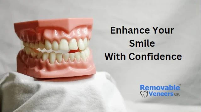 Perfecting Your Smile for the Big Day: Removable Veneers and Wedding Confidence