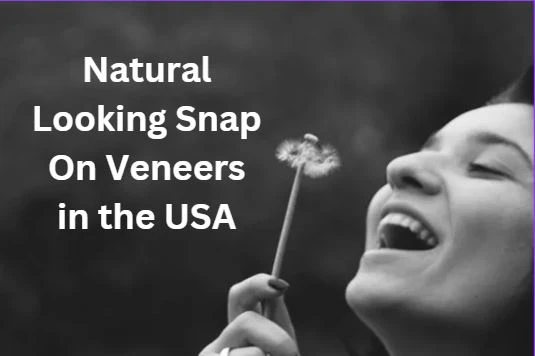 8 Reasons to Choose Removable Veneers over Permanent Veneers