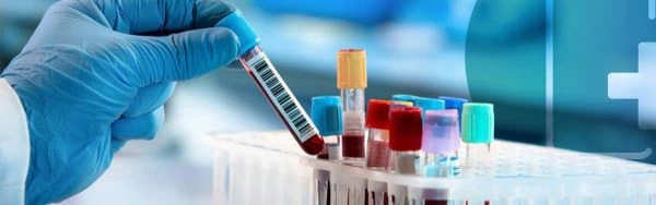 Blood test in Dubai | Blood test at Home Dubai | One call Doctor, UAE