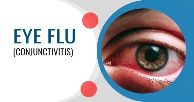 Clarity in Treatment: Conjunctivitis Market Solutions