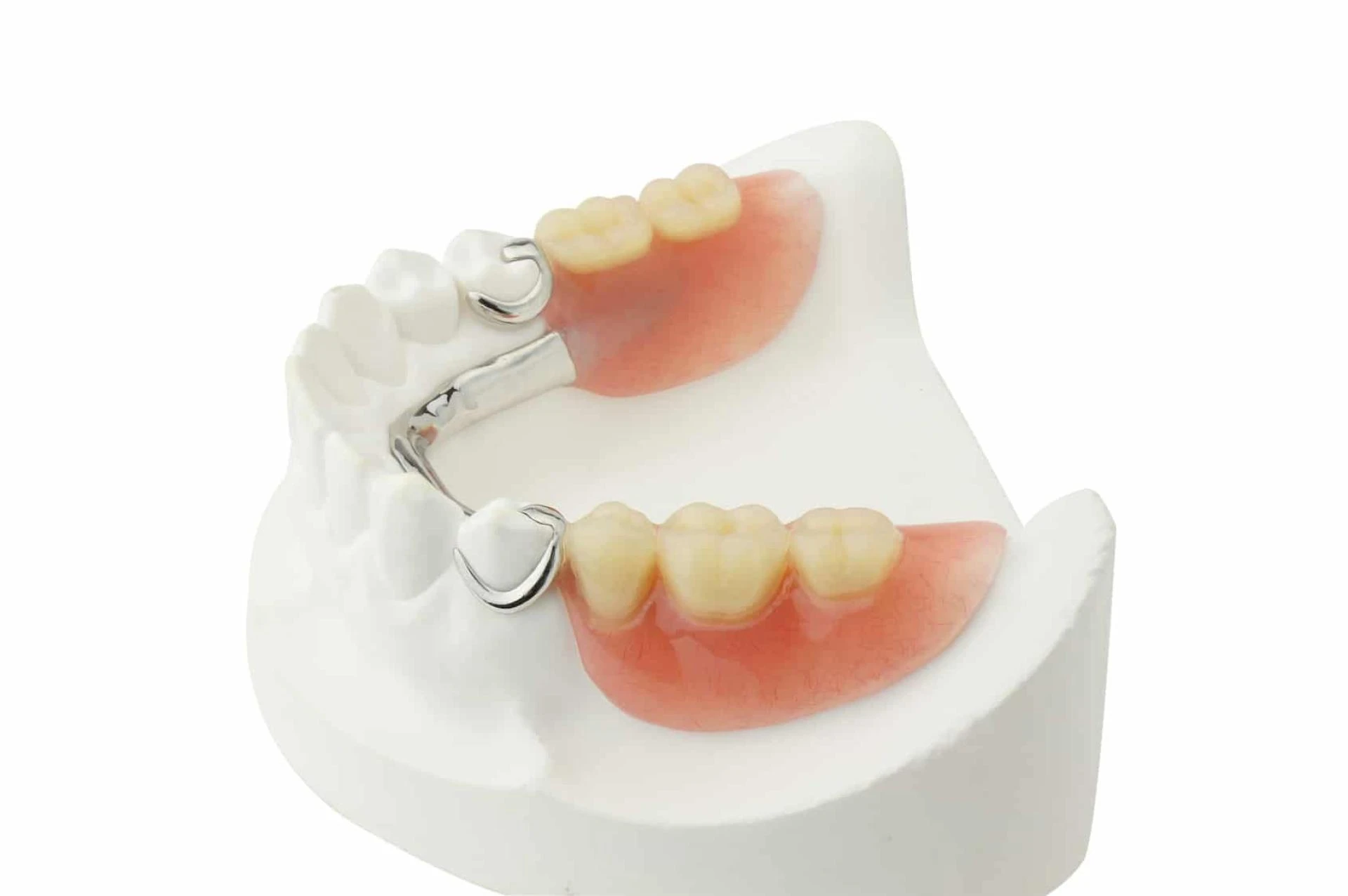 Partial Dentures: How to Choose the Right Ones for You