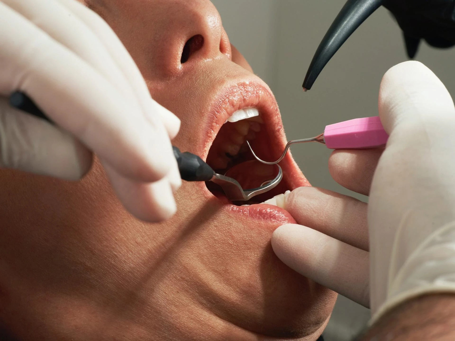 Taking Care of Your Teeth: Why You Should Seek Out a Huntsville Dentist.