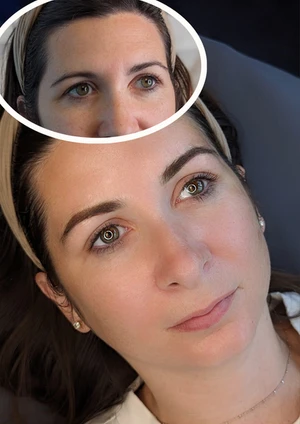 Revitalize Your Skin: The Ultimate Guide to Facials in Fairfax, VA