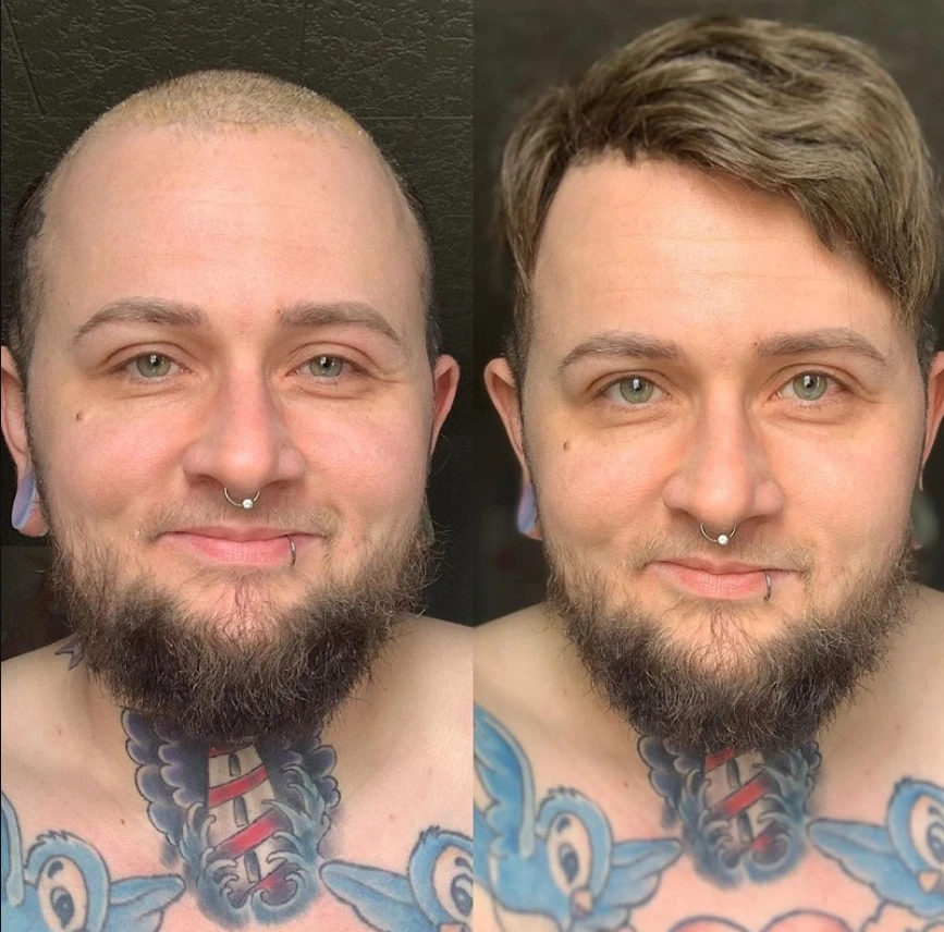 What is a male toupee?