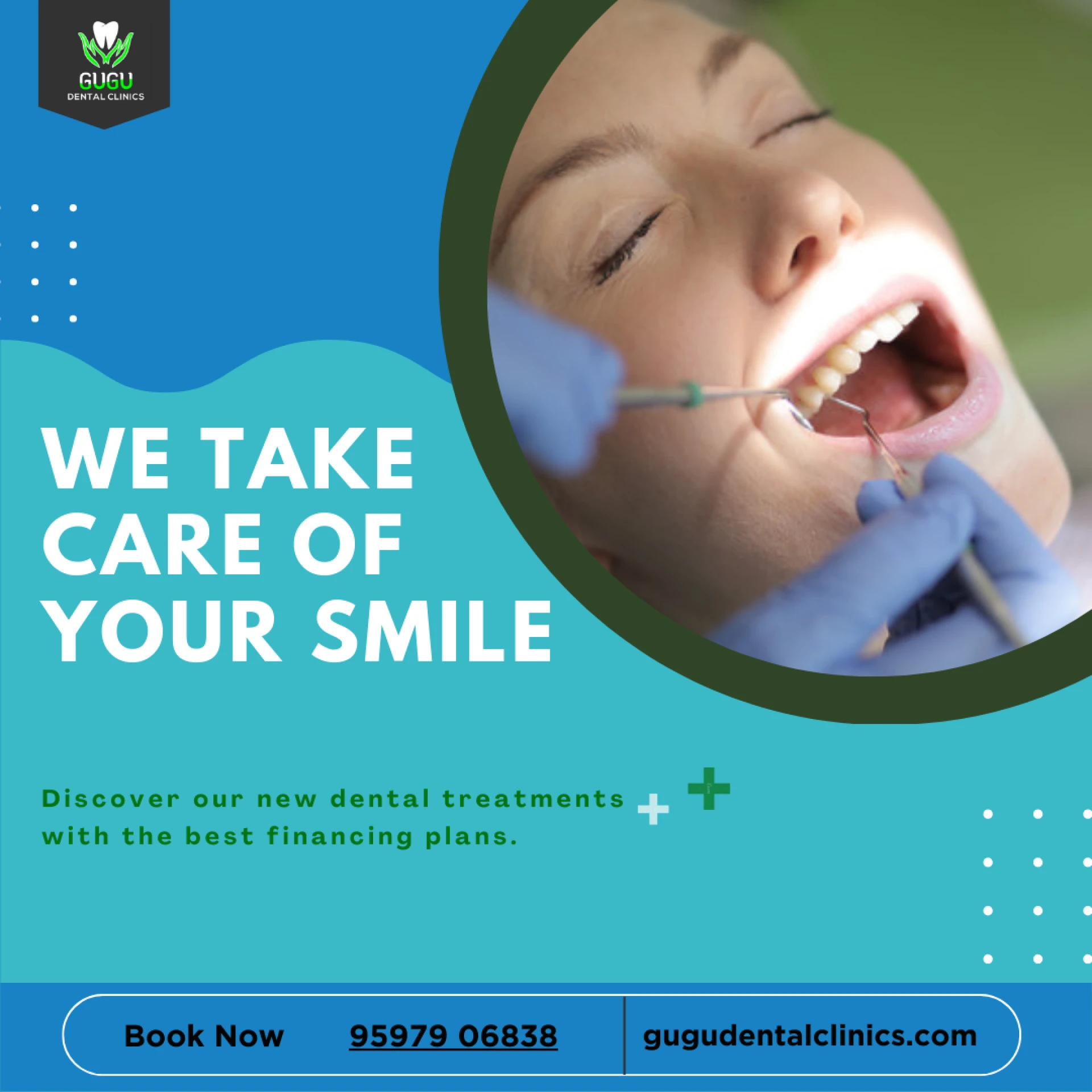 Root Canal in Saibaba Colony Coimbatore | Tooth Canal