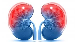 How to prevent Chronic Kidney Disease?
