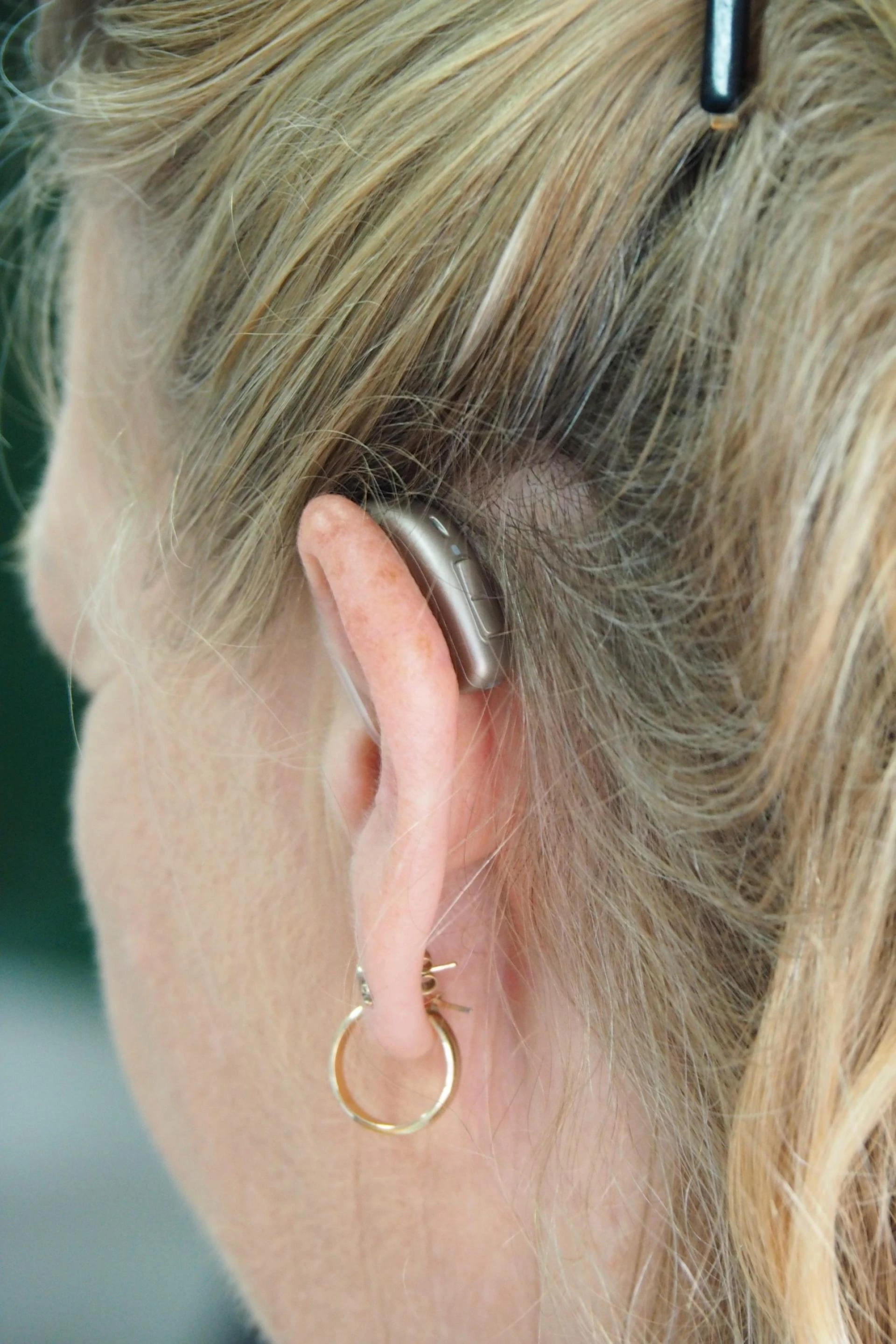 Invest In The Right Technology When Choosing Your Hearing Aids