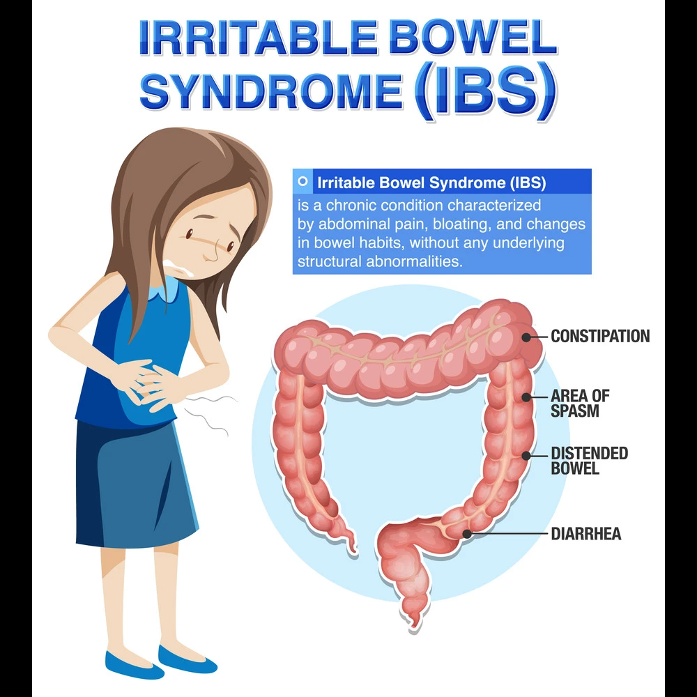 Ayurvedic Treatment for Irritable Bowel Syndrome (IBS)