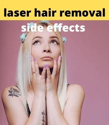 Laser hair removal side effects