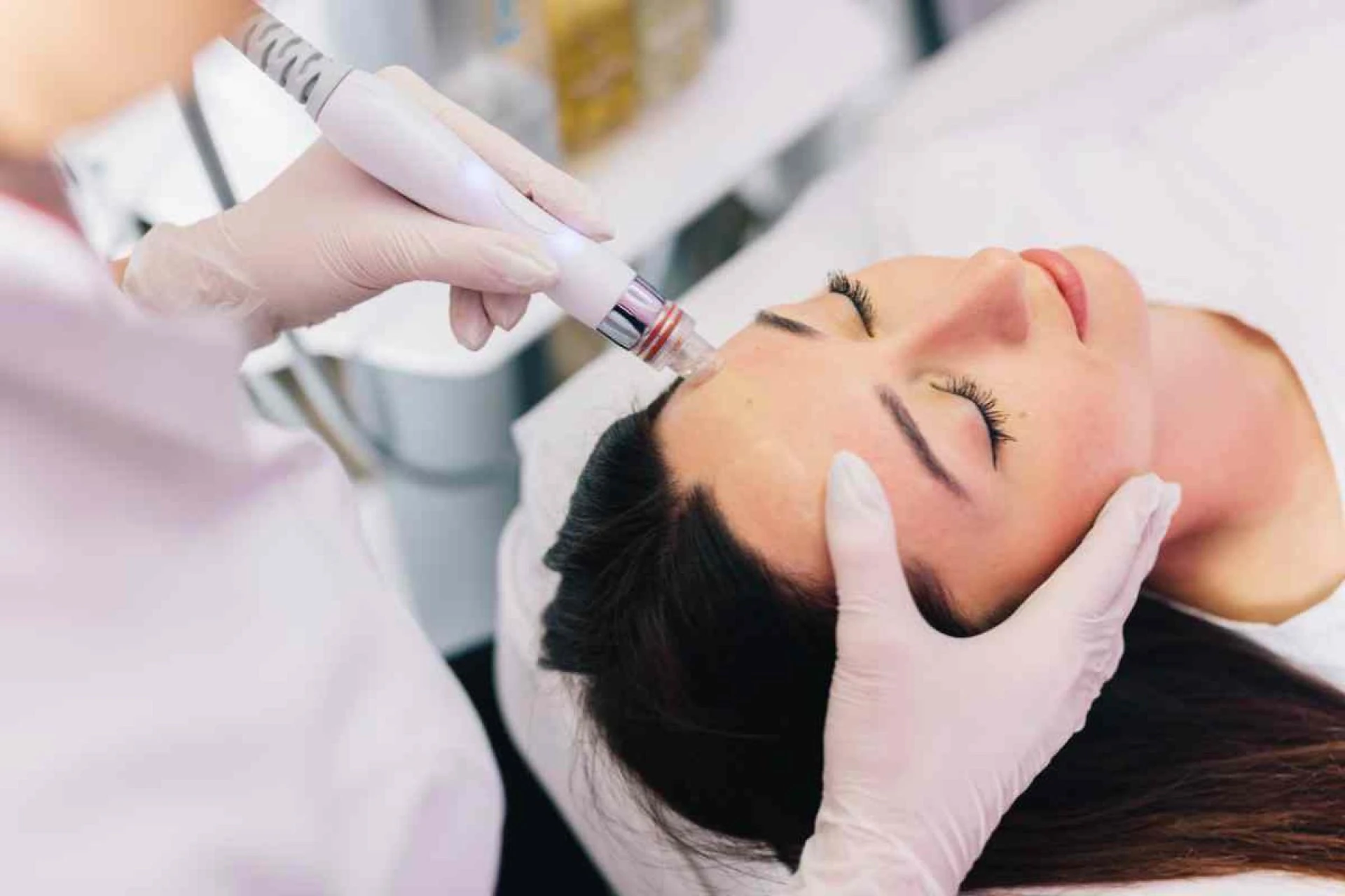 What Is a HydraFacial? Dermatologists Explain the Pore-Clearing Treatment