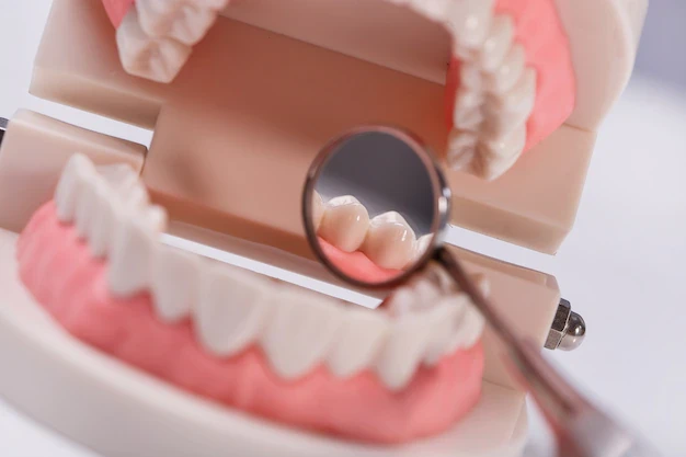 Simple Explanation of Tiny Dental Implants