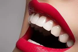 Benefits Of Hollywood Smile In Dubai