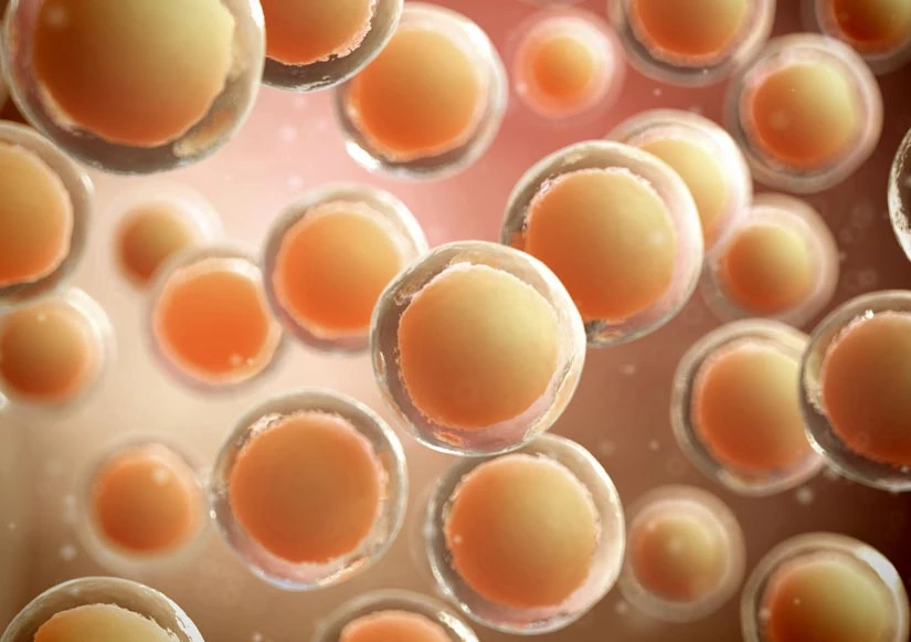 obesity and infertility
