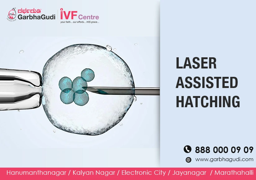 Laser Assisted Hatching