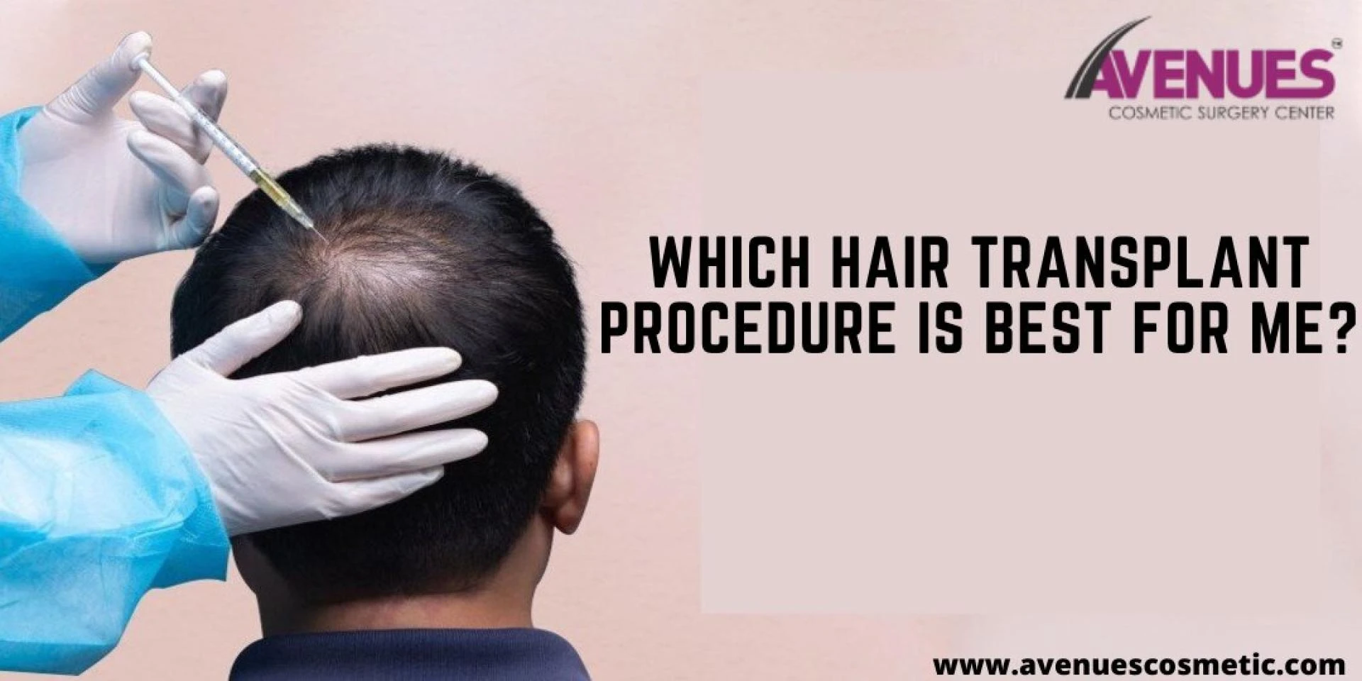 Which Hair Transplant Procedure is Best For me?