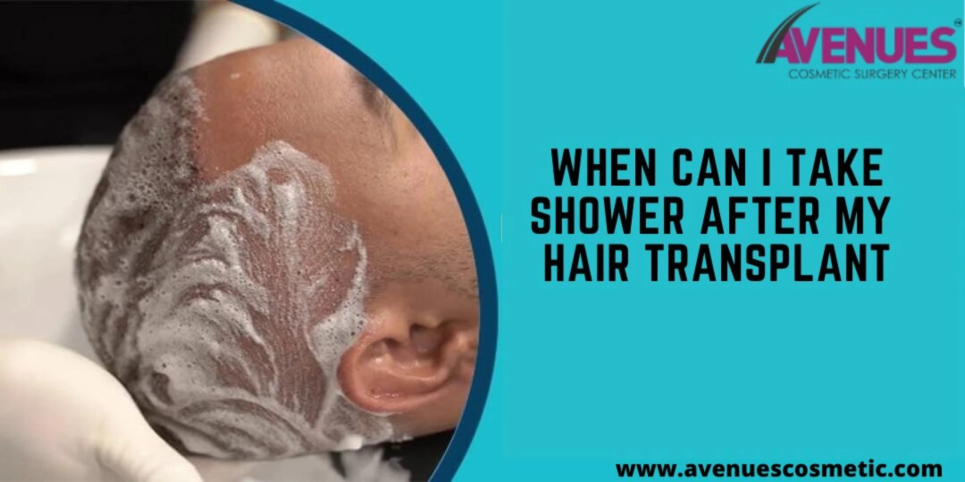 When Can I take Shower After My Hair Transplant?