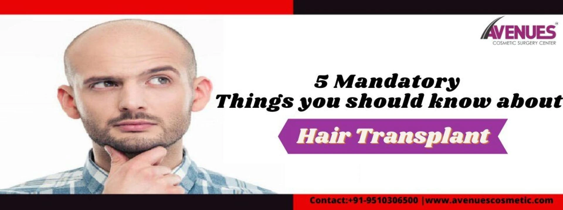 5 Important Things About Hair Transplant In Ahmedabad
