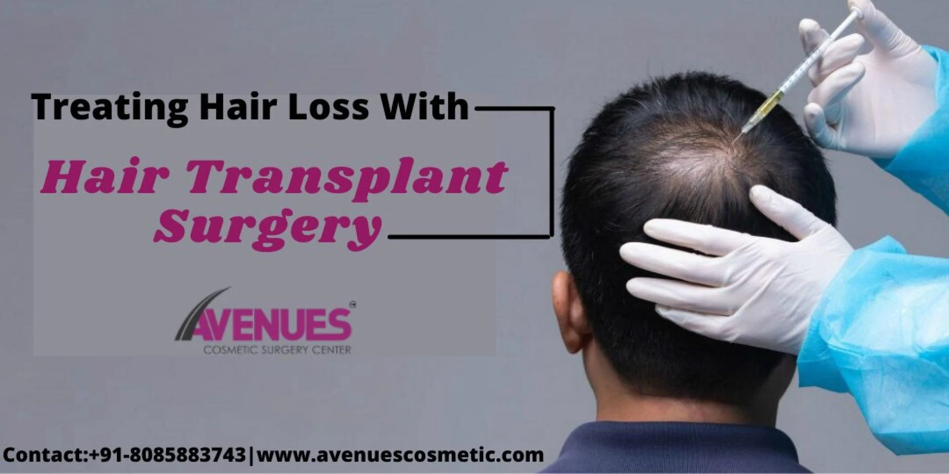 Treating Hair Loss With Hair Transplant Surgery At Avenues Hair Clinic in Ahmedabad