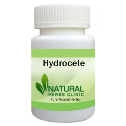 Herbal Treatment for Hydrocele | Natural Remedies | Natural Herbs Clinic