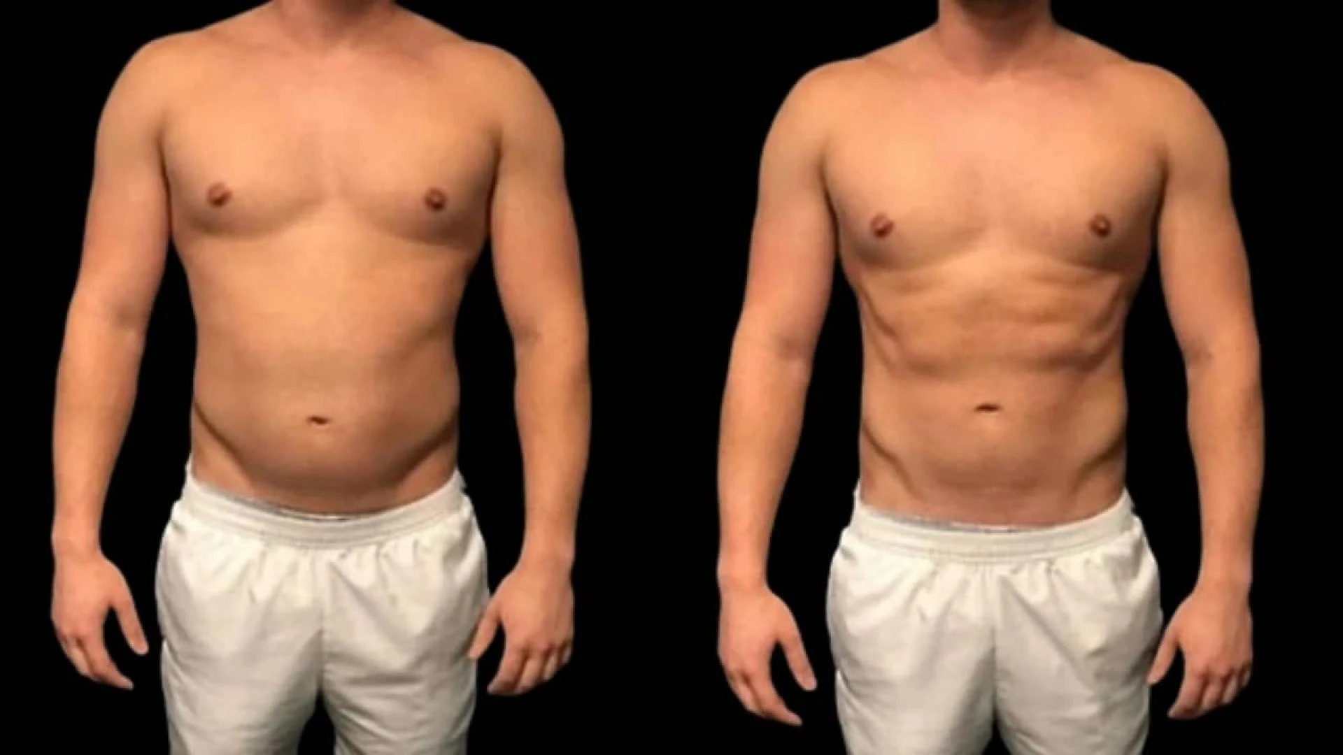 Male Body Sculpting Surgery for Different Age Groups