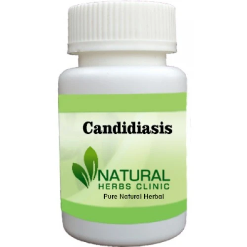 Herbal Treatment for Candidiasis | Natural Remedies | Natural Herbs Clinic