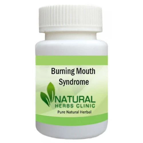 Herbal Treatment for Burning Mouth Syndrome | Natural Remedies | Natural Herbs Clinic