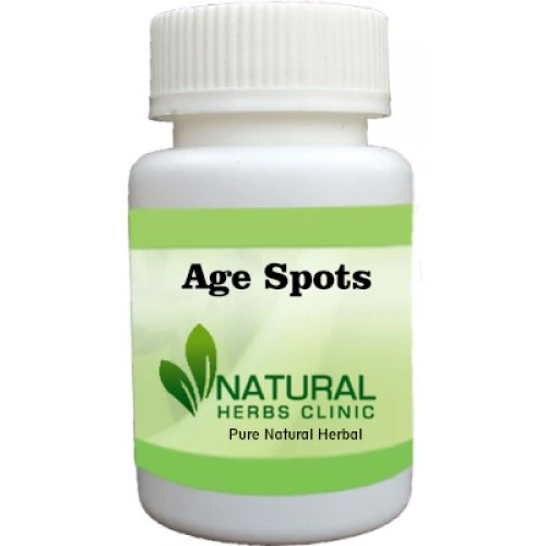 Herbal Treatment for Age Spots | Natural Remedies | Natural Herbs Clinic