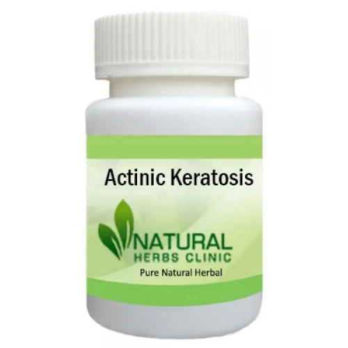 Herbal Treatment for Actinic Keratosis | Natural Remedies | Natural Herbs Clinic
