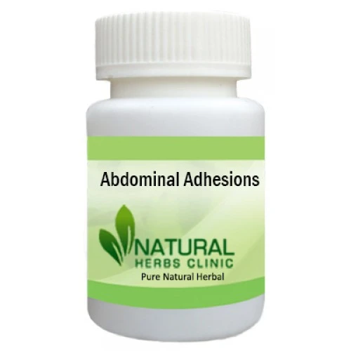 Herbal Treatment for Abdominal Adhesions | Natural Remedies | Natural Herbs Clinic