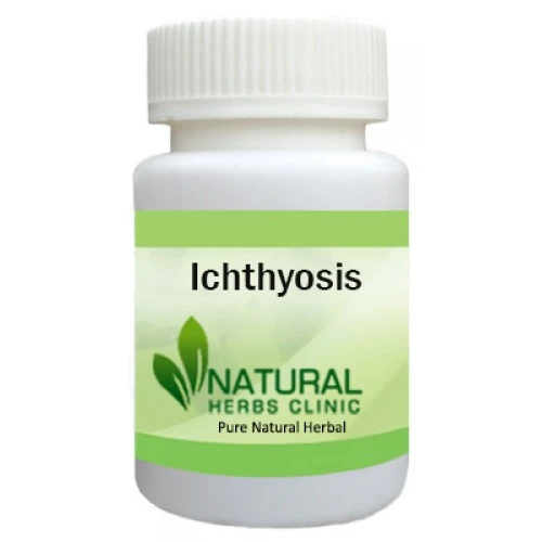 Herbal Treatment for Ichthyosis - Natural Herbs Clinic