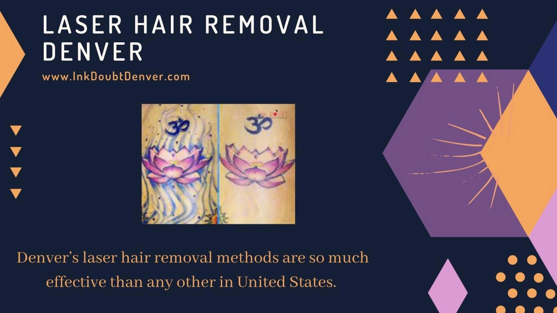 Contact for Denver laser hair removal treatment