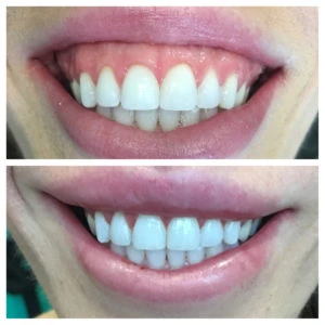 How D. Dental Handles Dental Emergencies in Dallas