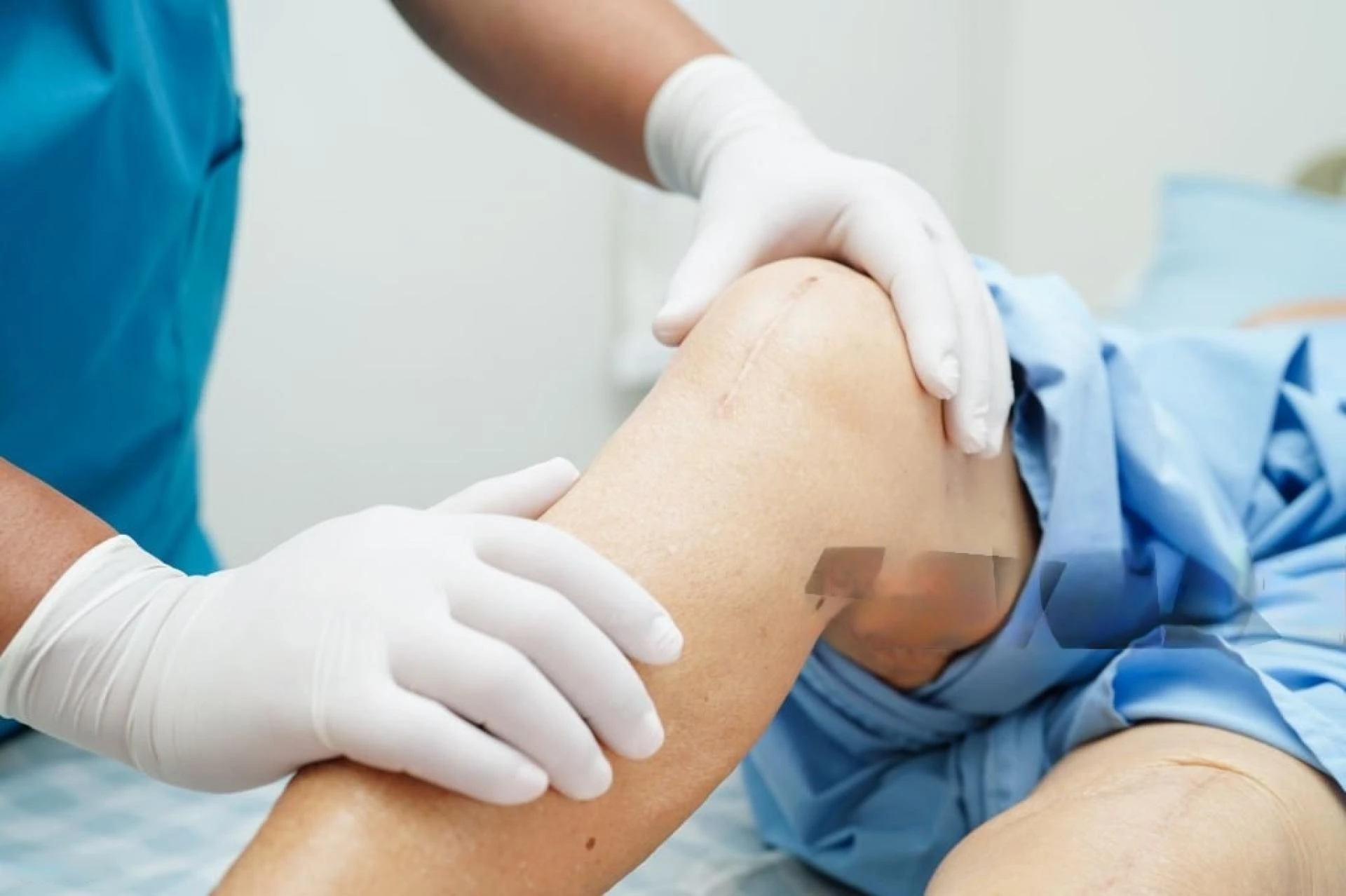 How Much Time Does It Take to Recover from Robotic Knee Replacement?