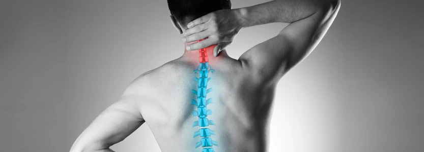 Everything You Need to Know About Kyphosis
