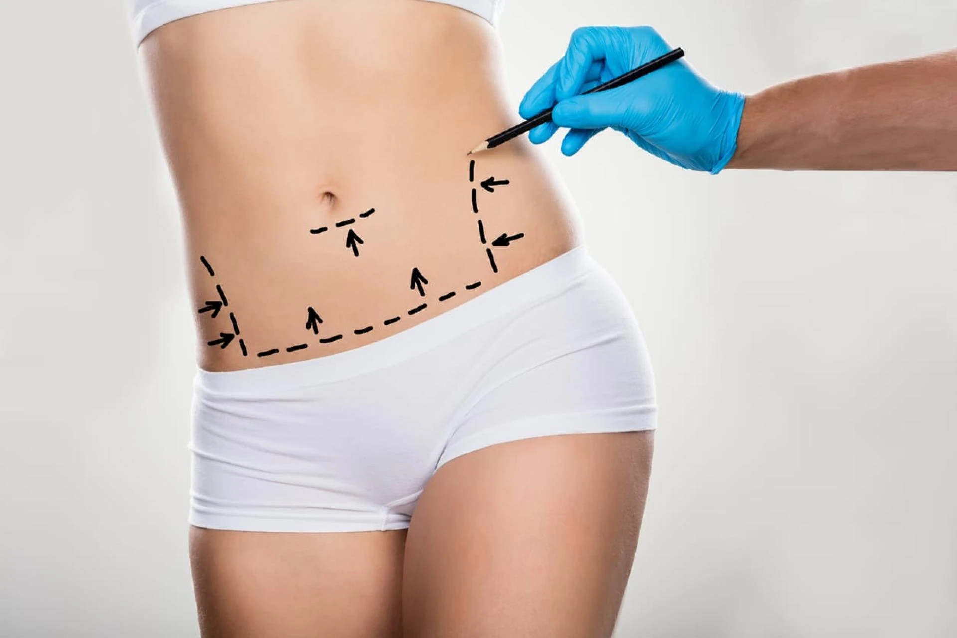 Understanding Laser Liposuction In Riyadh And How Does It Work