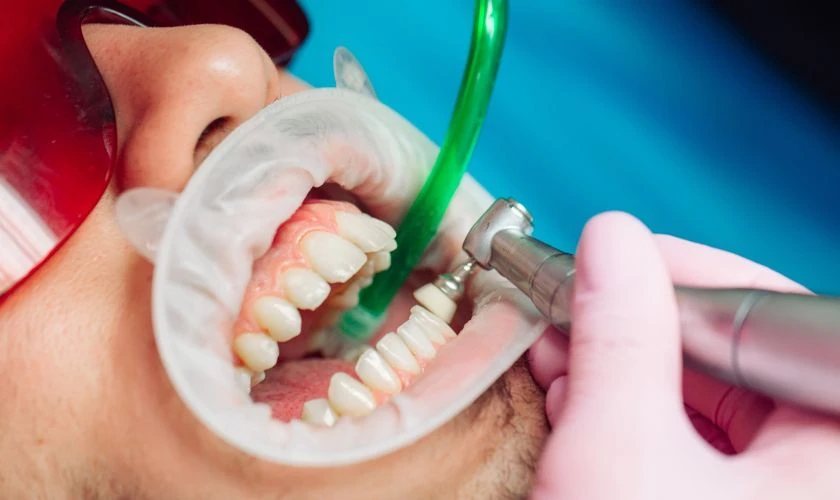 What Happens During a Teeth Cleaning Appointment in Tulsa?