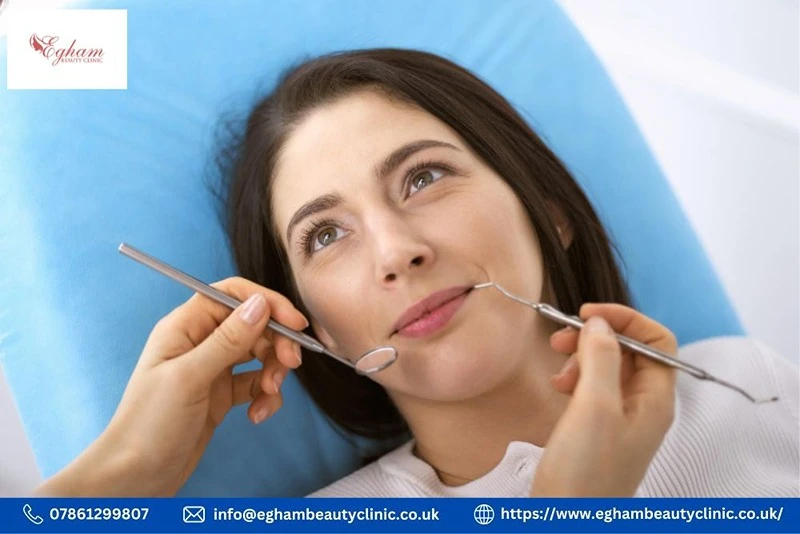 Dermal Fillers for Smile Lines: Unlocking the Secret to a Radiant Smile